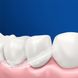 Зубная щетка Oral-B Vitality D100 Pro Protect X Clean CrossAction Black (D103.413.3)(черная)