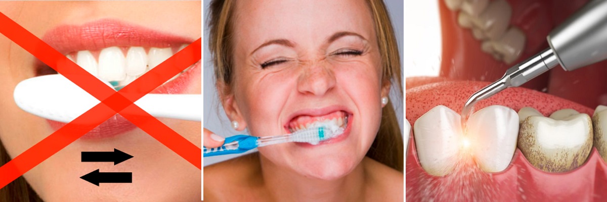 неправильная чистка зубов и зубной камень могут привести к чувствительности зубов